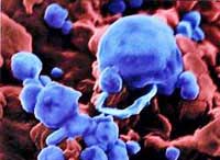 Picture 5 of First published photo of avian influenza virus