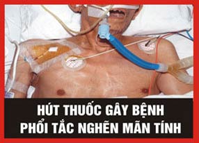 Picture 2 of Five warning images must be printed on cigarette packs