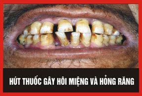Picture 5 of Five warning images must be printed on cigarette packs