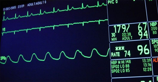 Picture 1 of Fix heart defects within 20 minutes