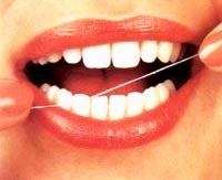Picture 1 of Flounder teeth cause gingivitis