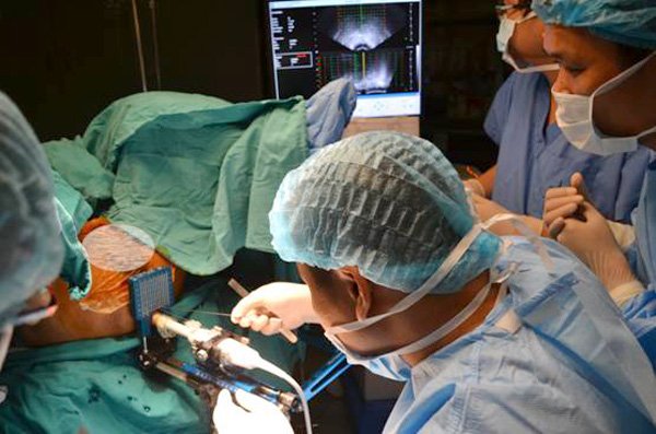 Picture 1 of For the first time, implant successful cancer treatment beads in Vietnam