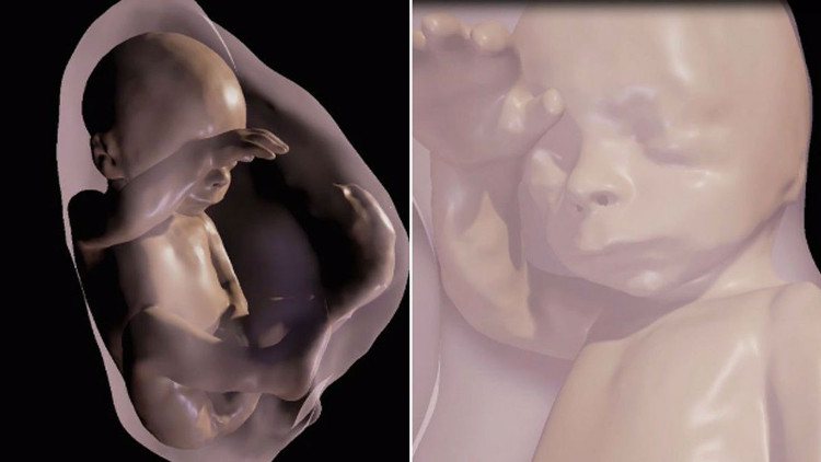 Picture 1 of For the first time parents can meet the fetus through 3D virtual reality