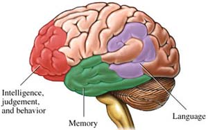 Foreign language 'hold' dementia images 1