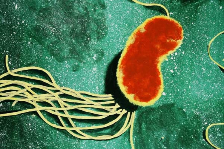 Picture 4 of Forget sharks, these 5 bacteria also make you