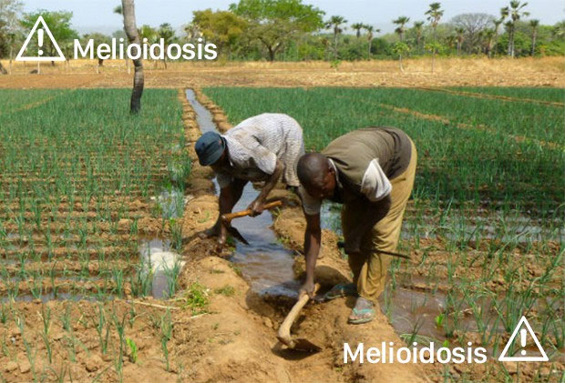 Picture 2 of Forgotten killer disease: Farmers' bare feet and mud in the field