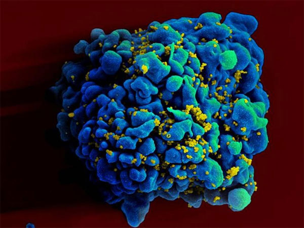 Picture 1 of Found a vaccine for HIV?