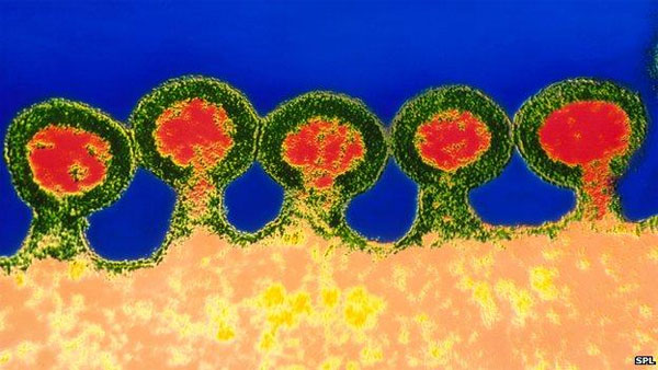 Picture 1 of Found the 'pure' of the HIV virus