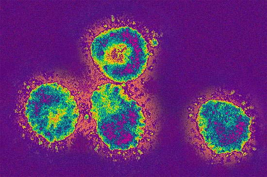 Picture 1 of France: Two more suspected cases of SARS virus infection