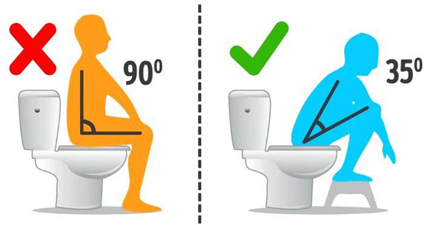 Picture 2 of Frequently asked questions about defecation habits that you are not sure yet