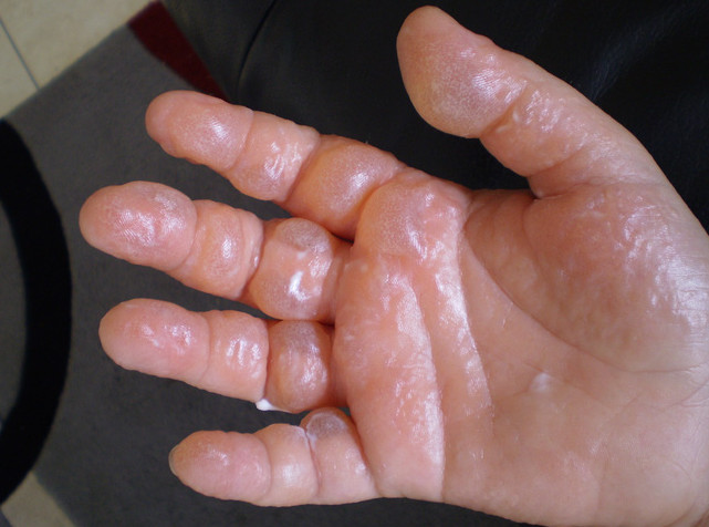 Picture 2 of Freshest fruits in the summer can cause this