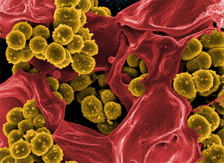 Picture 1 of From milk from the Tasmanian devil to super antibiotic