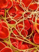 Picture 1 of Frozen blood is more elastic than rubber