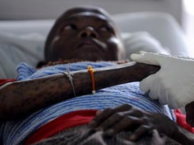 Picture 1 of Gene therapy - New weapon to treat HIV / AIDS