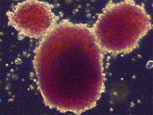 Picture 2 of Generate stem cells from unfertilized eggs