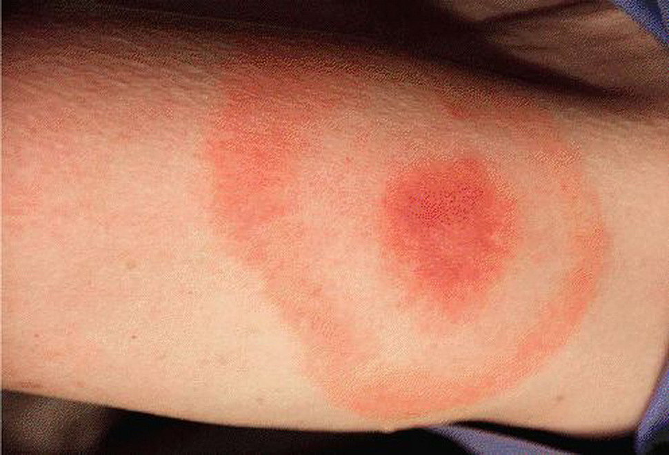Picture 13 of Giant mosquitoes have bone-piercing blood