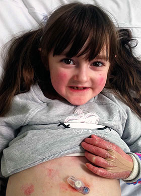Picture 1 of Girls have delicate skin like butterfly wings