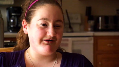 Picture 3 of Girls with disease do not know pain