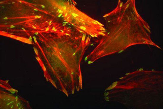 Picture 1 of 'God's finger'