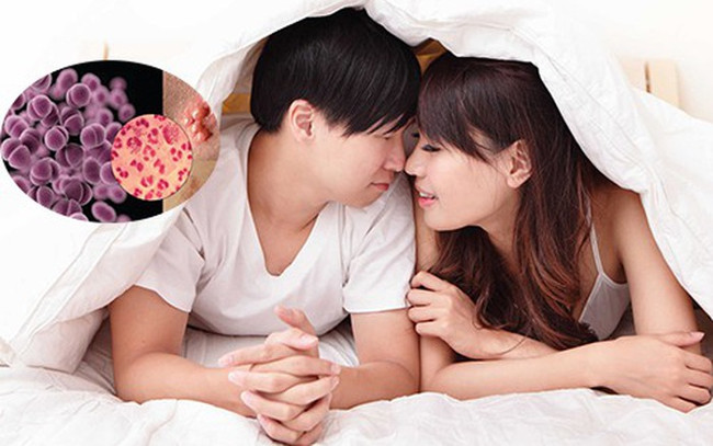 Picture 1 of Gonorrhea spreads for centuries because of unsafe sex