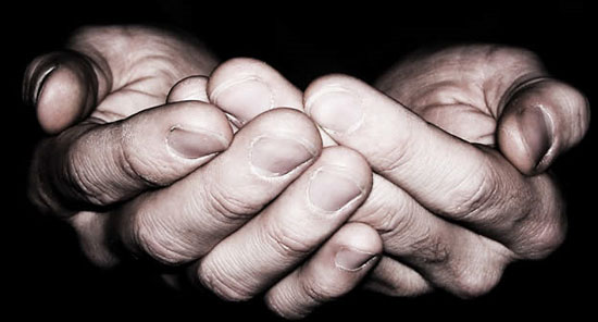Picture 1 of Guess the disease through the length of the finger