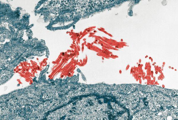 Picture 1 of H1N1 virus is much more dangerous than human thought