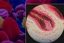 Picture 1 of Hair follicle germ cells help to recover nerve damage