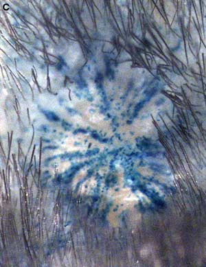 Picture 3 of Hair-forming stem cells have been tested in rat skin