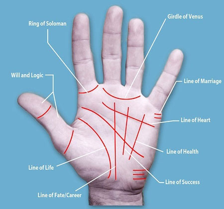 Picture 1 of Hand surgery to change fate