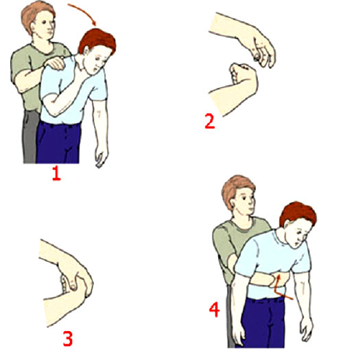 Picture 2 of Handbook of accident first aid at home