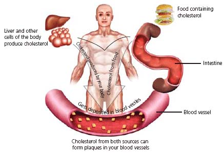Picture 1 of HDL cholesterol reduces the risk of bowel cancer