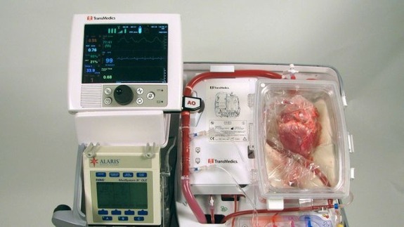 Picture 2 of He first successfully operated a dead heart transplant