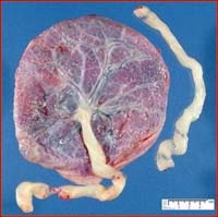 Picture 2 of He successfully separated stem cells from umbilical cord membranes