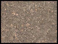 Picture 3 of He successfully separated stem cells from umbilical cord membranes