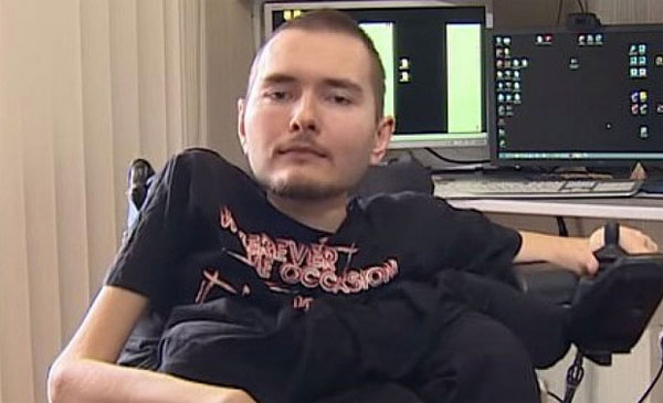 Picture 2 of Head transplants can take place in China