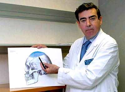 Picture 1 of Height increase thanks to silicon implants