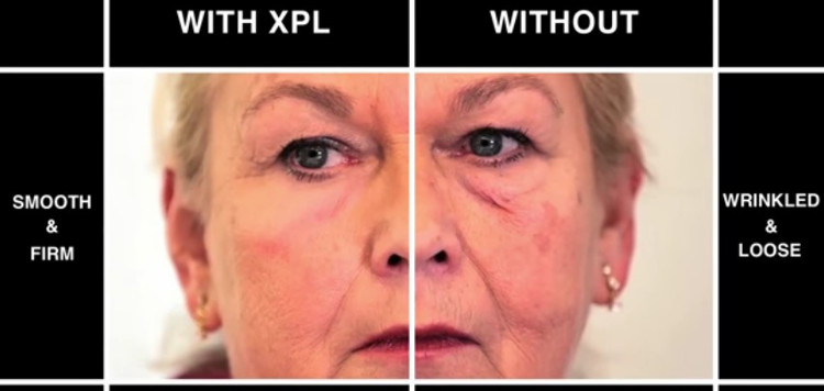 Picture 1 of Help the young face to be 20 years old by 'applying' artificial skin