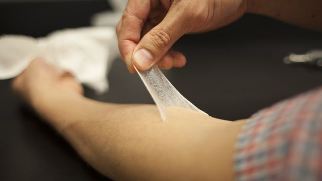 Picture 2 of Help the young face to be 20 years old by 'applying' artificial skin