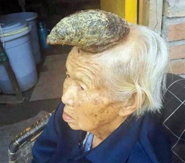 Picture 1 of Her grandmother grew a strange long horn on her head