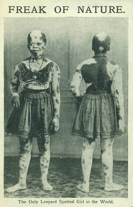 Picture 2 of Heterosexuals of the entertainment industry in the early 20th century
