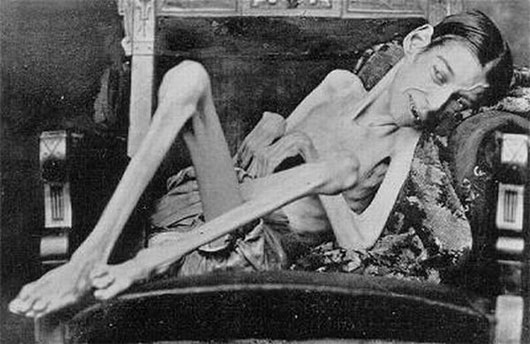 Picture 5 of Heterosexuals of the entertainment industry in the early 20th century