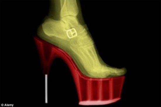Picture 1 of High heels - painful for beauty