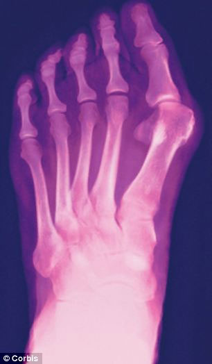 Picture 2 of High heels - painful for beauty