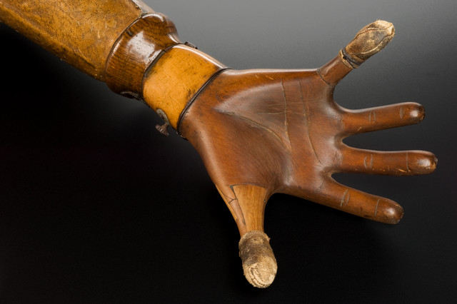 Picture 3 of History of making artificial limbs in the world