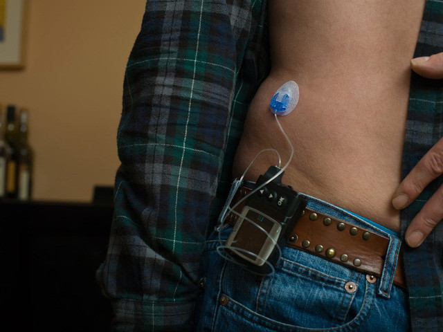 Picture 9 of History of nearly 100 of insulin - the source of life for people with diabetes