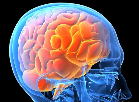 Picture 1 of HIV virus increases the proportion of patients with dementia