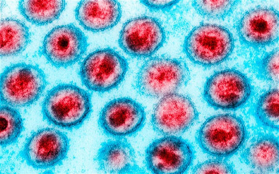 Picture 1 of HIV-infected baby girl is cured