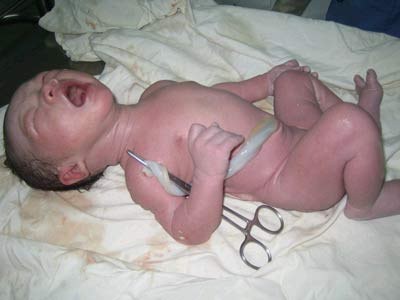 Picture 1 of Ho Chi Minh City: Establishment of umbilical cord blood bank