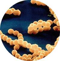 Picture 3 of Ho Chi Minh City: Meningococcal necrosis secretly plays dough