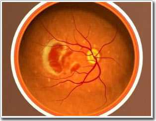 Picture 1 of Hope to treat corneal damage